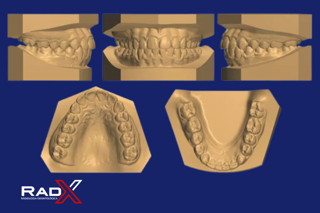 Modelos Odontológicos