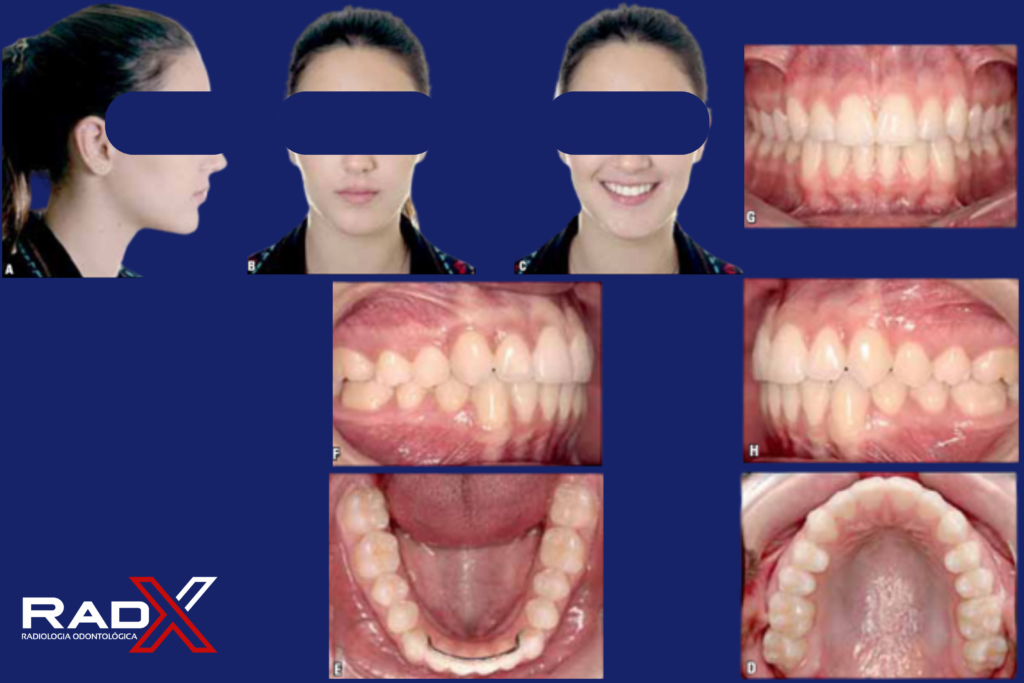Fotografias Odontológicas
