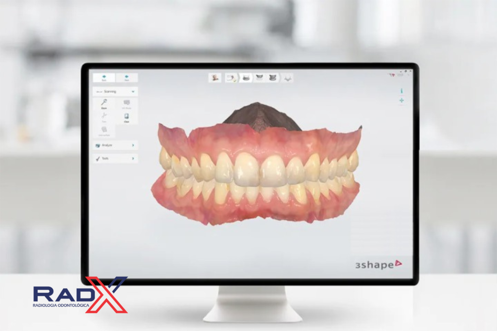 Escaneamento Intraoral