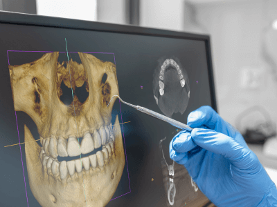 Tomografia Odontológica Tomografia Dentária Dente