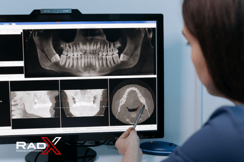 Tomografia Odontológica Tomografia Dentária Dente