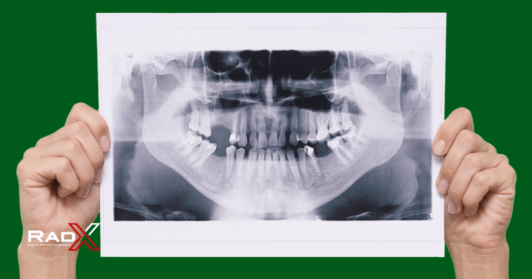 Radiografia Panorâmica Preço Valor