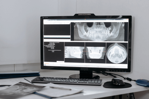 RadX Radiologia Odontológica
