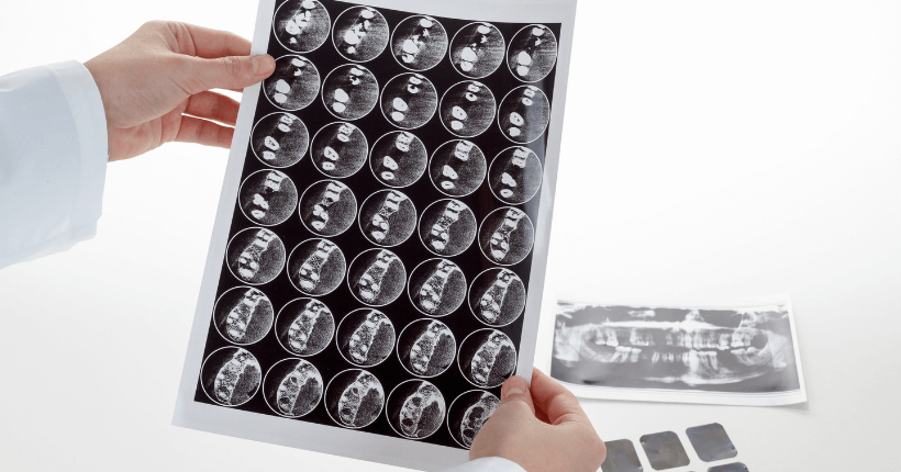 Tomografia Odontológica Preço
