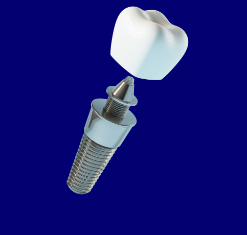 cicatrização implante dentario