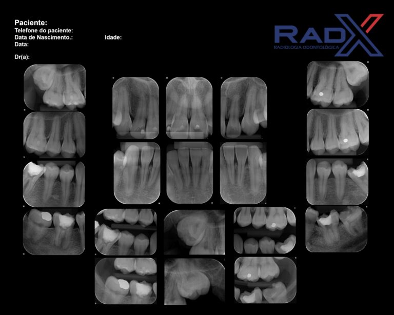 RAdiografia periapical preço quanto custa periapical completo