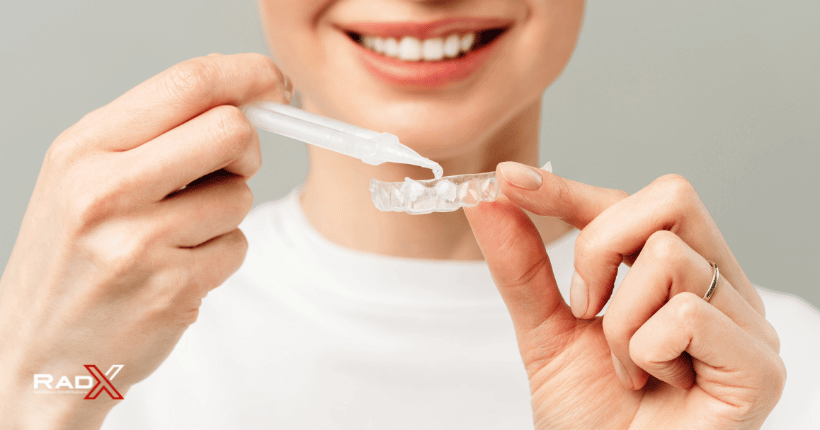 Clareamento dental caseiro Clareamento dentario caseiro Clareamento dentes caseiro