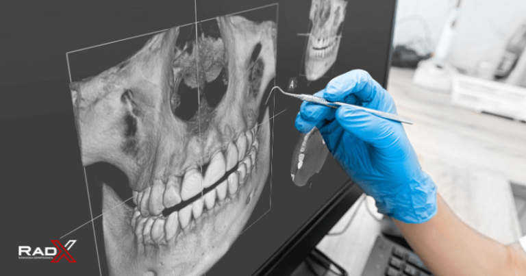 Radiografia odontológica Radiologia odontológica