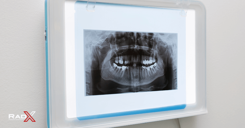 Radiografia panoramica odontológica